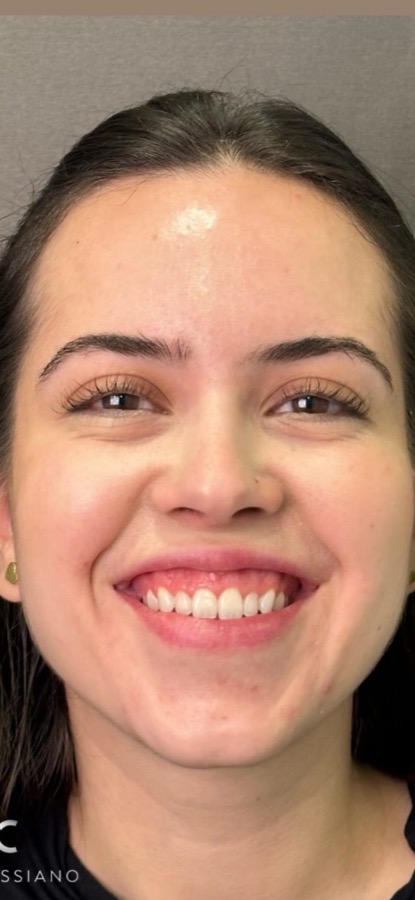 Depois